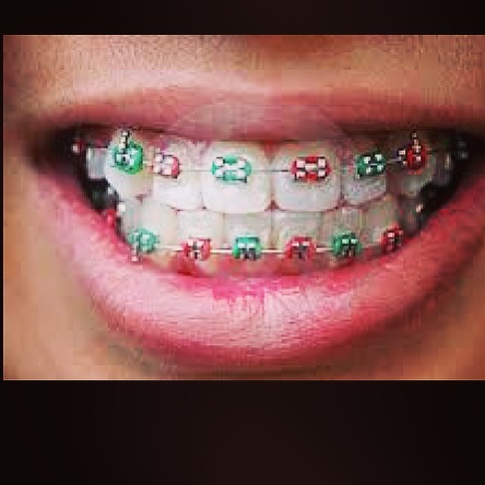 Kids Orthodontist Dana Point, CA